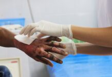 Types of Burn Injuries: Understanding Degrees and Causes Burn Injuries